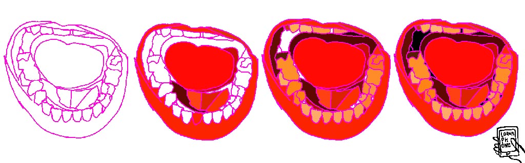 trump mouths lornaphone